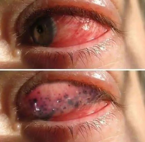 The Real Consequences of Sleeping With…