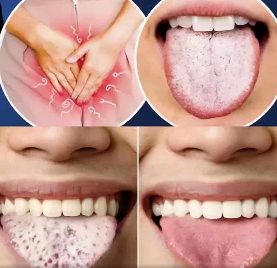 11 Things Your Tongue is Telling You About Your Health
