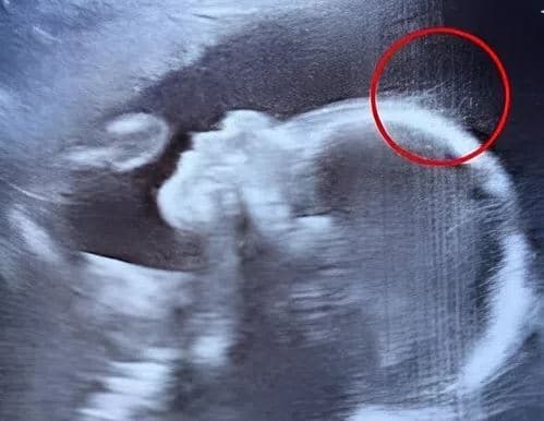 What Doctors Spotted on the Ultrasound Left Them Speechless — And This Baby Girl Captivated Everyone from the Moment She Was Born