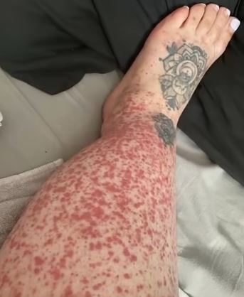 These are the consequences of sleeping in…
