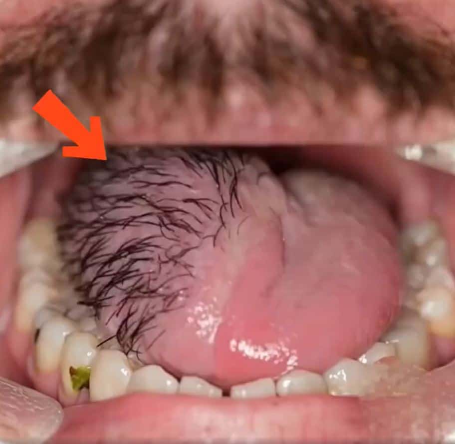 These Are The Consequences Of Eating Cr…
