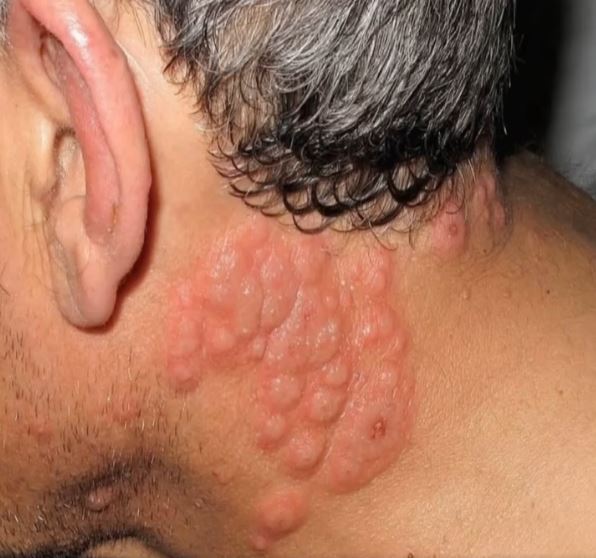 These are the consequences of sleeping with…