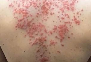 These are the consequences of sleeping with the…