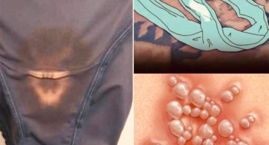 BE CAREFUL, if you notice this in your underwear, it means you have!!