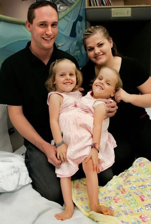 The conjoined twins were separated after a complex surgery։ See what they look like after the operation