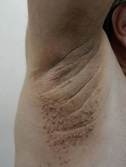 These are the first symptoms of cr…