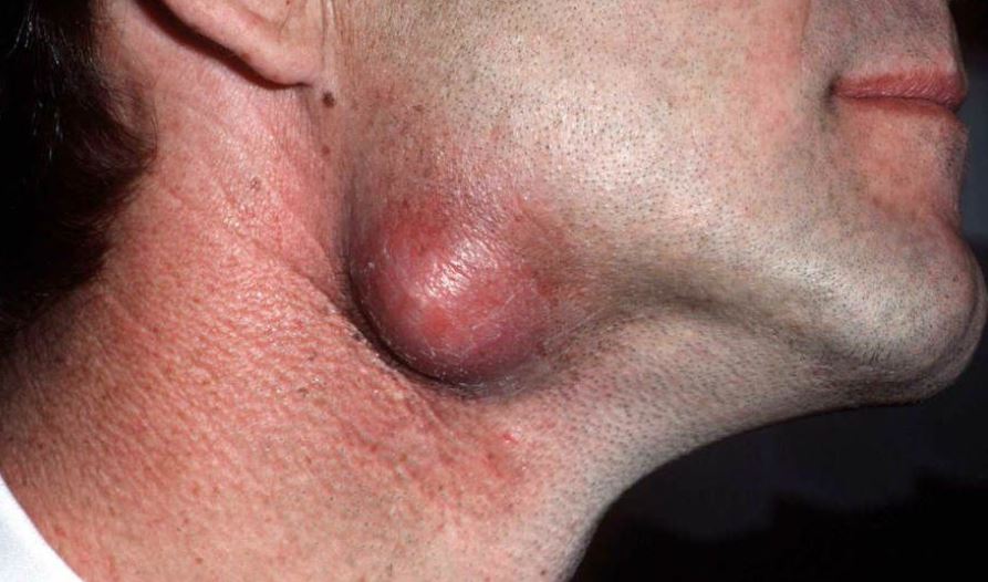 These Are the Signs That It’s Getting Serious: Don’t Ignore Them