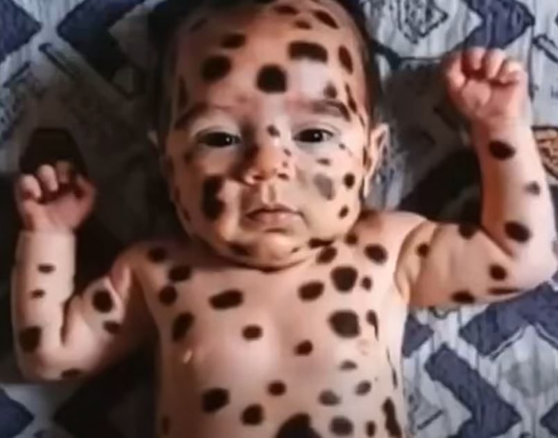 Doctors forced to do emergency caesarean section – dad sees baby’s face and room falls silent