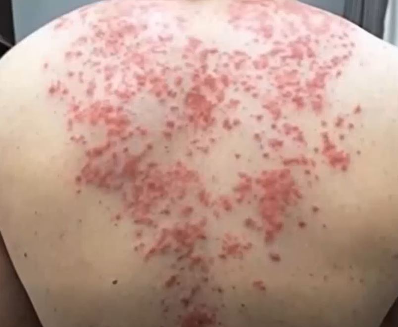 These are the consequences of sleeping with the…