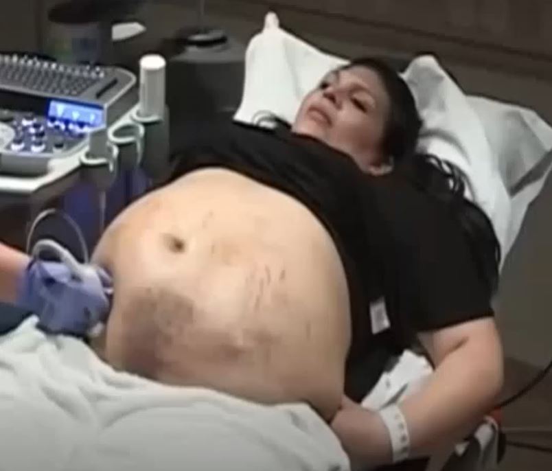 Doctors Reveal the Unbelievable Truth Behind a Pregnant Mother’s Struggles