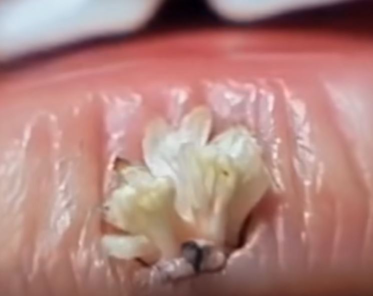 Be very careful. If you catch this, you’re infected with…