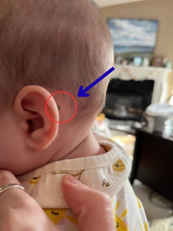 My newborn is only fifteen days old. After the bath, while I was combing his thin hair, I noticed something completely unexpected that shocked me and made me rush to the hospital, and what I found will surprise you.