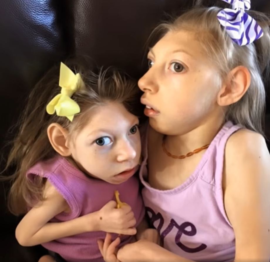 Kansas mother of two diagnosed with microcephaly speaks of joy and struggle: ‘We love our lives’ and here’s what she has to say