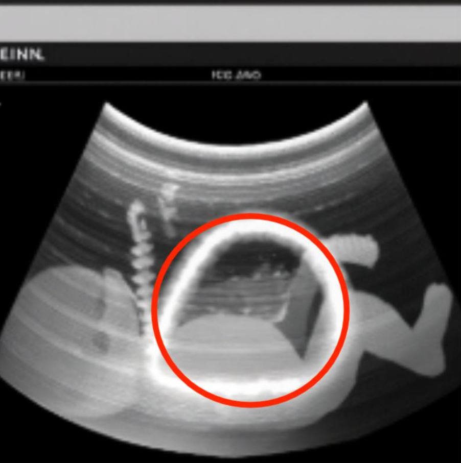 The ultrasound showed something that only the doctor understood, what secret was hidden in that little body surprised everyone.