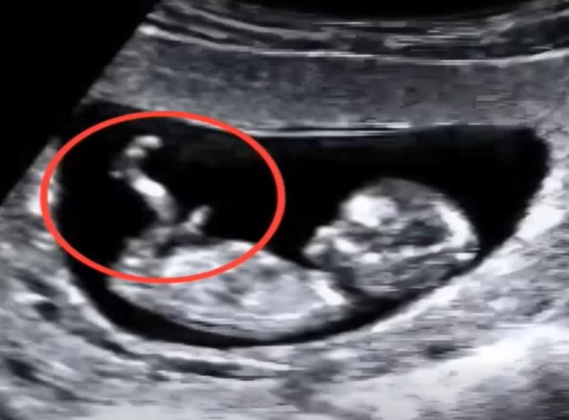 I hadn’t visited a doctor during my travels while pregnant. At the hospital, the doctor’s words froze me․