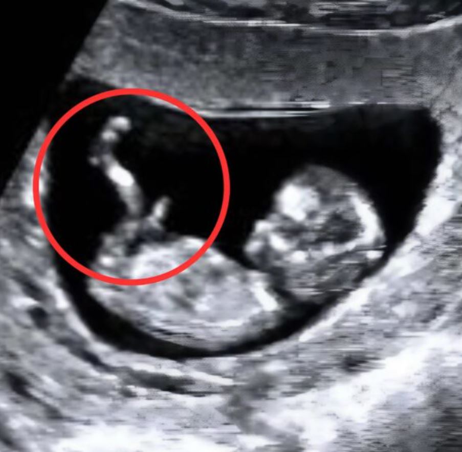 I hadn’t visited a doctor during my travels while pregnant. At the hospital, the doctor’s words froze me․