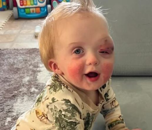 The child born with genetics is growing up with this face, here is what they look like now