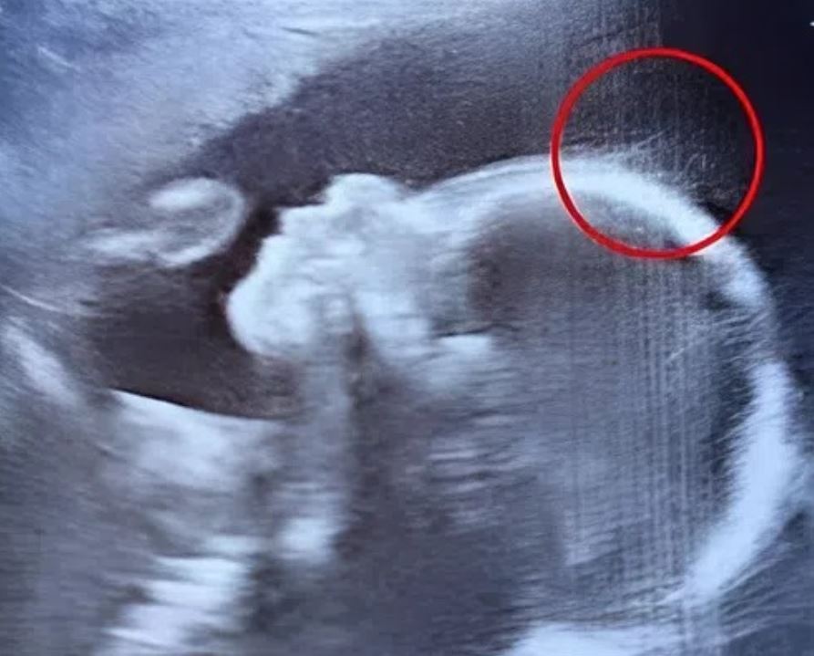 What Doctors Spotted on the Ultrasound Left Them Speechless — And This Baby Girl Captivated Everyone from the Moment She Was Born