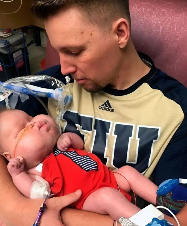 The boy with the unusual face grew up to become an internet star. What is he like today?