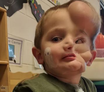 The mother of a 5-year-old boy has a message for those who called her son a «monster» after he was bitten by dogs. Here’s what he looks like after surgery.