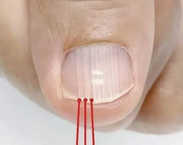 If You Notice These Lines on Your Nails After 40, Here’s What It Really Means