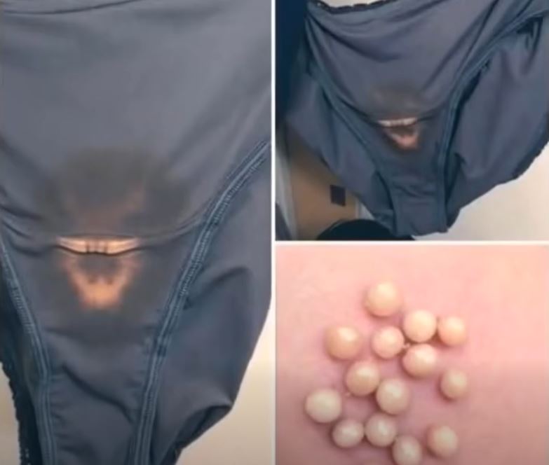 BE CAREFUL, if you notice this in your underwear, it means you have!!