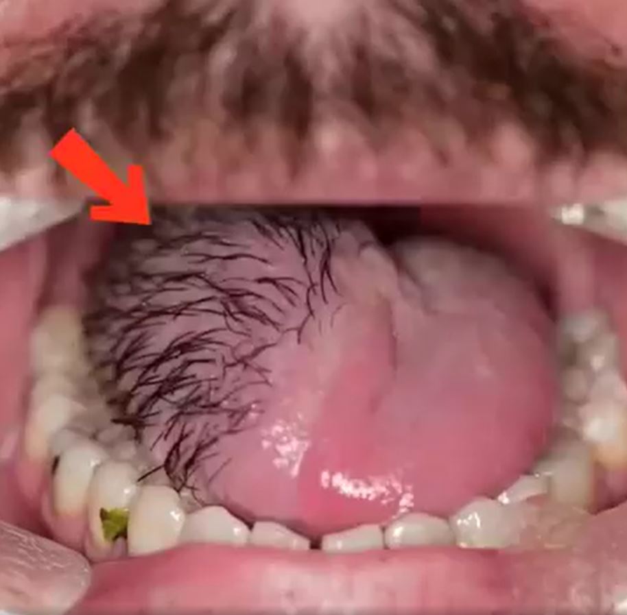 These Are The Consequences Of Eating Cr…