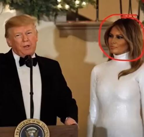 At Mar-a-Lago, Melania Trump Sparks Cosmetic Surgery Rumors