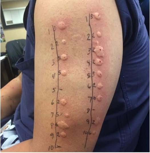 SB. These are the consequences of sleeping with the…