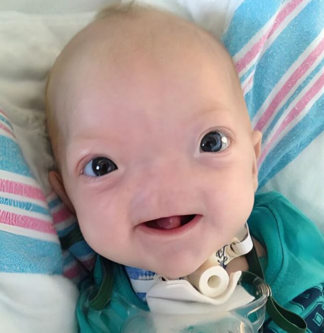 He was born without a nose, with a special mission. Everyone looked at his appearance, but his true secret is only revealed at the end of the story.