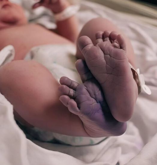 He was born the way no one expected… his tiny feet scared everyone, but then the doctors discovered something that changed everything