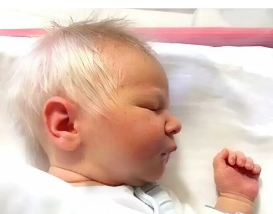 This baby was born with white and gray hair: see what this unusual child will look like years later