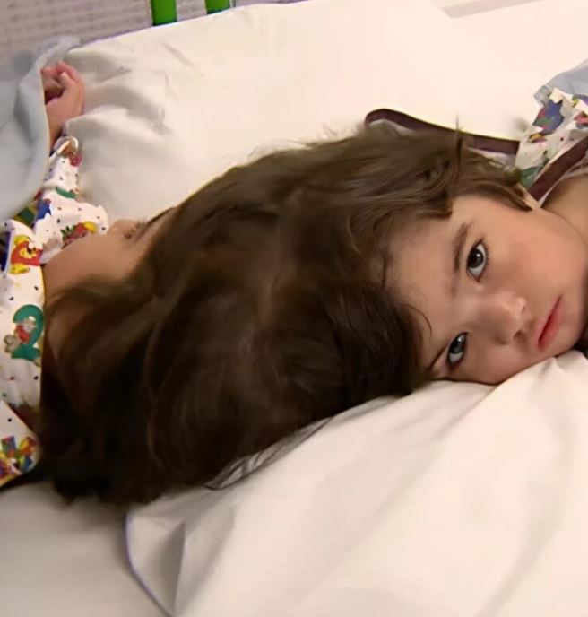Conjoined twins separated after complex surgery. See what they looked like two years later.