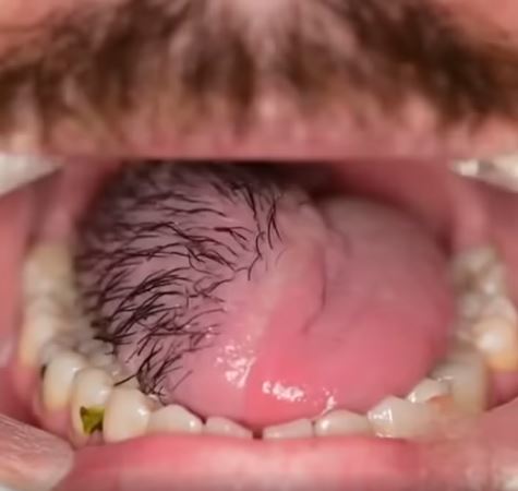 These are the consequences of sleeping with