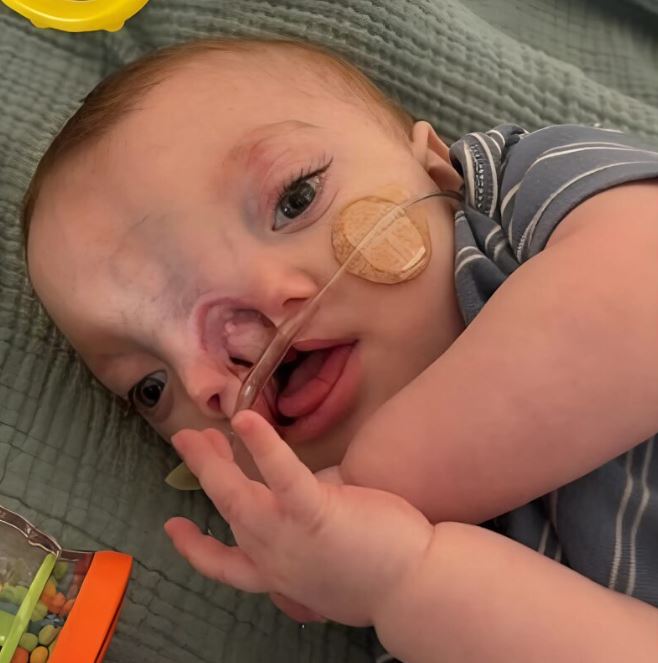 A baby born with a facial deformity undergoes serious surgery, here’s what happens to him.