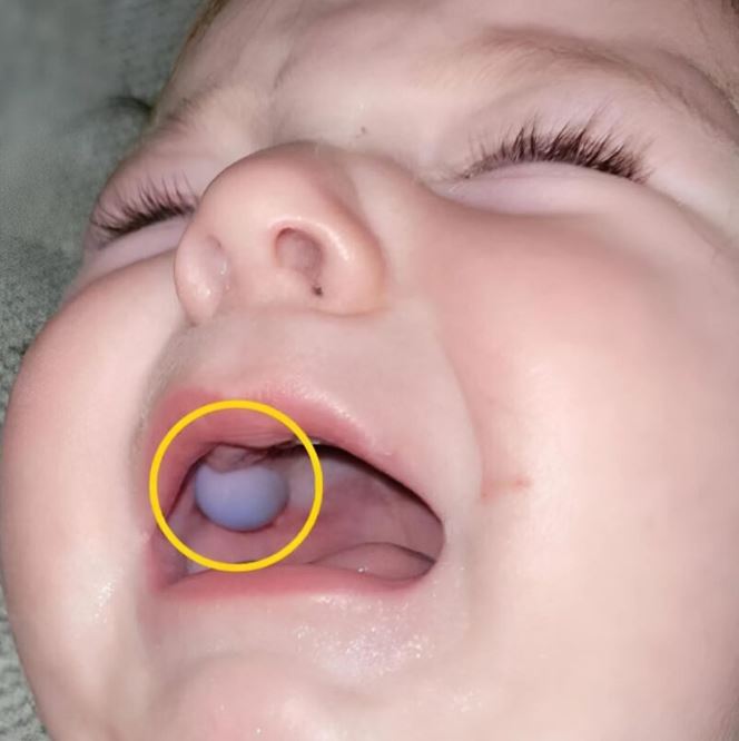 I noticed something strange in my son’s mouth and rushed him to the doctor. What the doctors discovered in the little child’s mouth shocked us all.