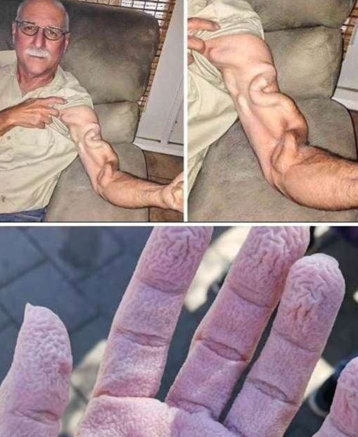 A Man Goes to Stretch and Ends Up Feeling a Sharp Pain in His Arm, It Was a Case That Shocked Everyone