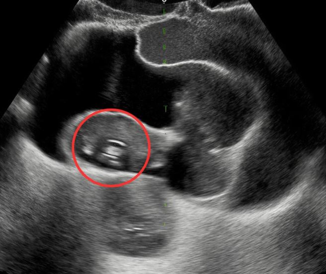 For a month, persistent stomach pain disrupted my days. Feeling increasingly unwell, I finally visited a doctor. His unexpected diagnosis left me speechless and completely shaken.