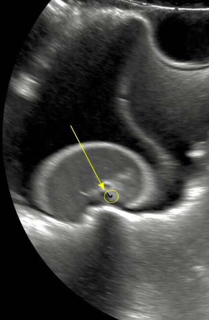 My daughter kept complaining of stomach pain. At the hospital, tests turned silent, then the doctor whispered urgent surgery, and my world collapsed as questions and fear flooded every thought.