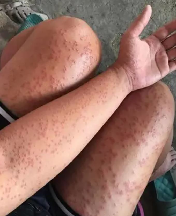 I spent a couple of nights at my friend’s previous apartment and saw these unusual bumps