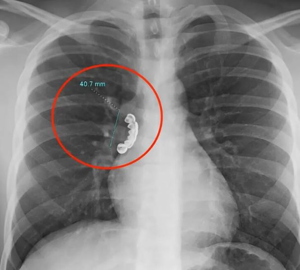 A secret that was hidden behind medical walls, but led to the discovery of a silent rescue, a dangerous breathing, a viral and unexpected fatal connection through a single accident.