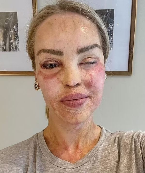 Acid attack victim becomes the author of her incredible transformation after 16 years of struggle