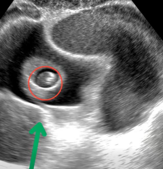 I asked my neighbor to watch my baby for just twenty minutes while I ran to the store. But five hours after returning, my daughter cried out in stomach pain. At the hospital, the doctor stared at me in shock.