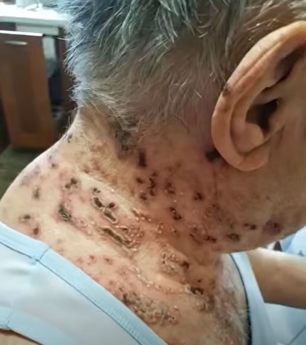 This is the silent disease that is triggered when you come into contact with!