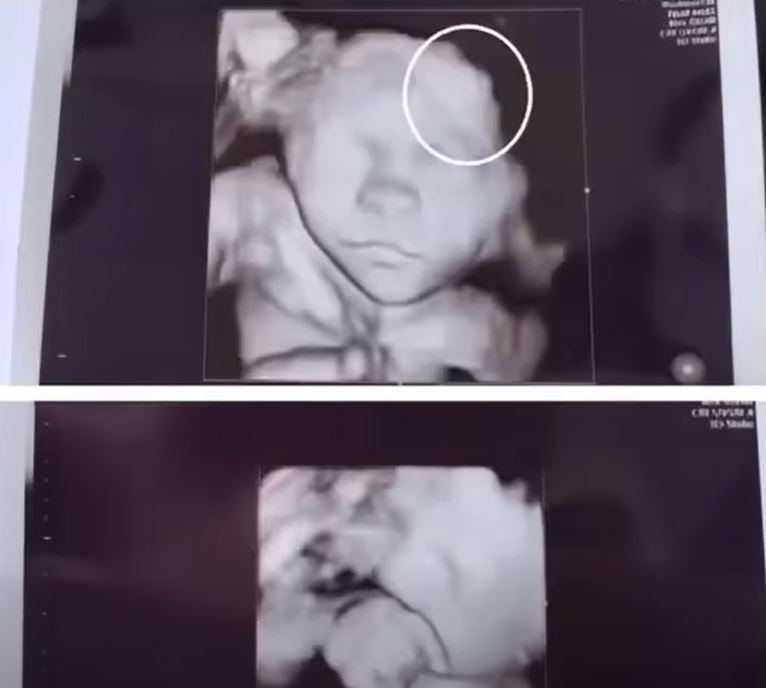 Mother is scared to see her daughter’s ultrasound; image showed the…