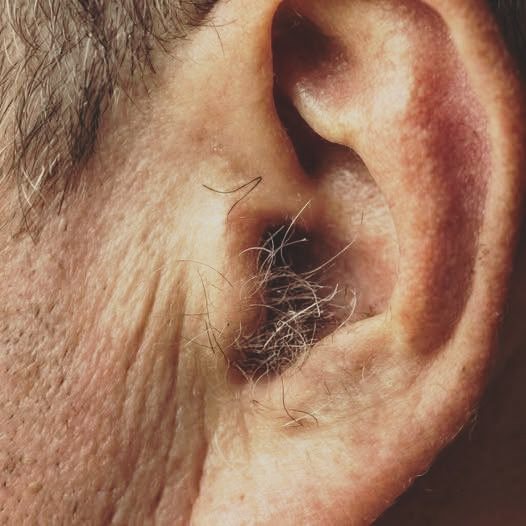 Did you know that hair growth on the ears isn’t a sign of illness? It’s simply a natural part of aging, influenced by hormones, genetics, and the passage of time.