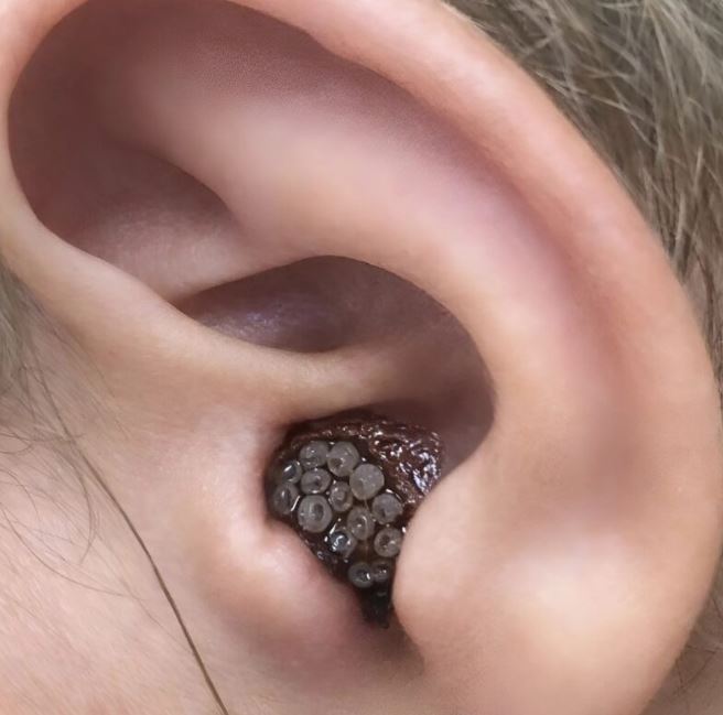 I noticed something strange in my child’s ear, thinking it was a wound, but what the doctor told us shocked us and filled us with terror.