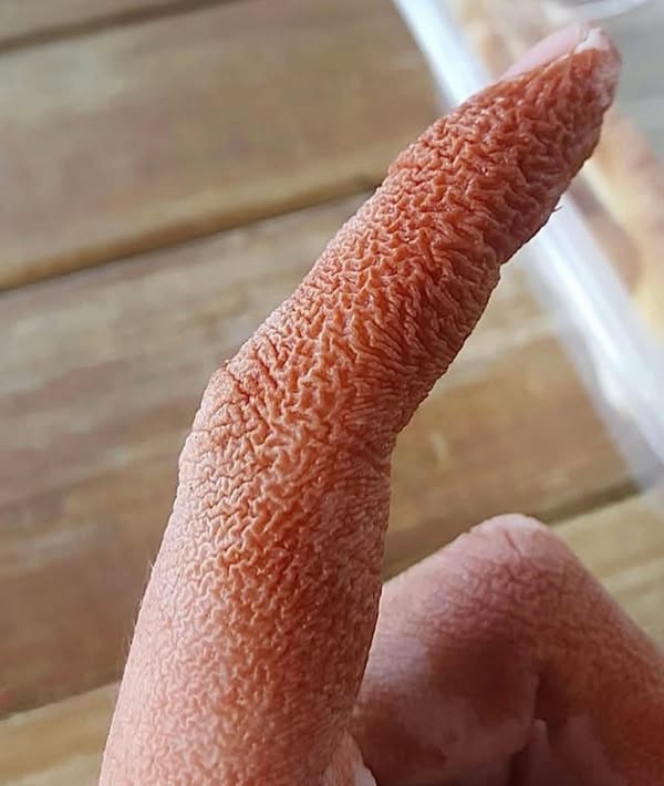 ALERT: These are the signs that it is cre…