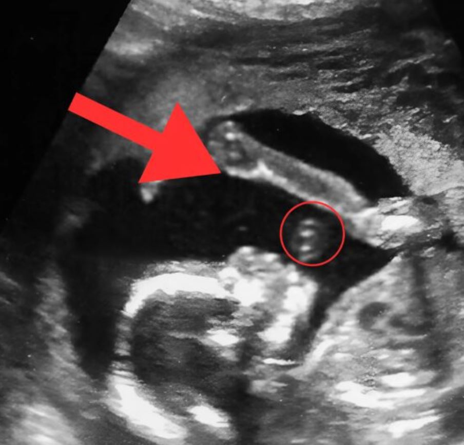 During the ultrasound, the doctor suddenly stopped, studied my facial expression, and said with surprise that the results were completely unexpected, changing the entire meaning of the visit in an instant.