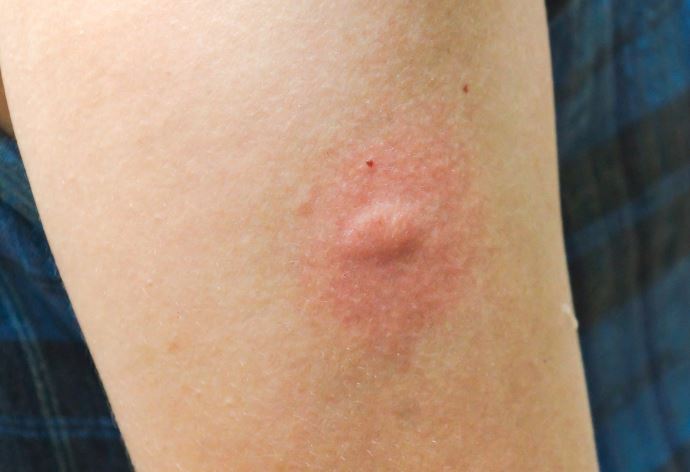 These are the consequences of sleeping with your c…